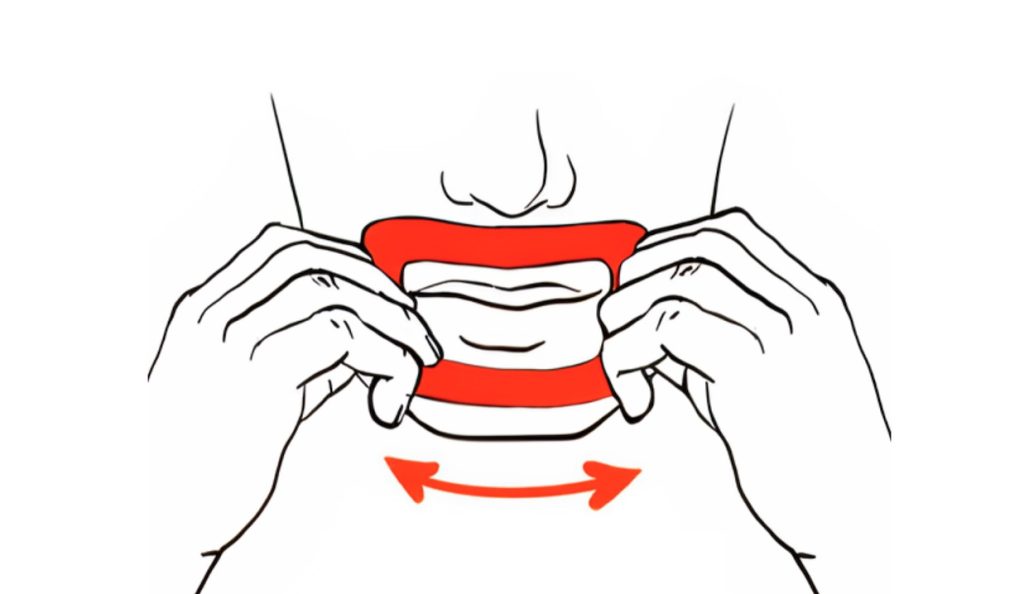 Myotape mondplakker bevestigen obat